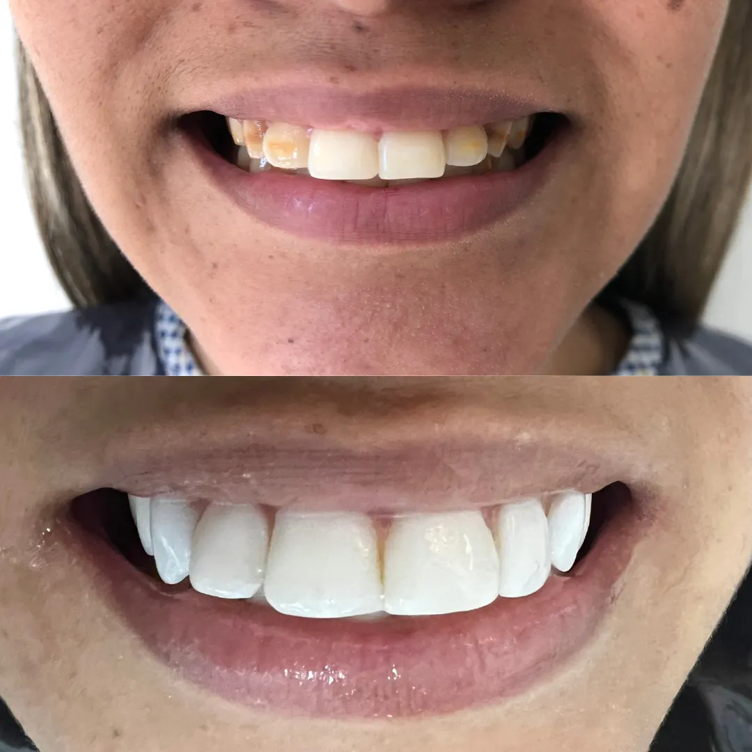 dentista lentes de contato dental centro niteroi rj