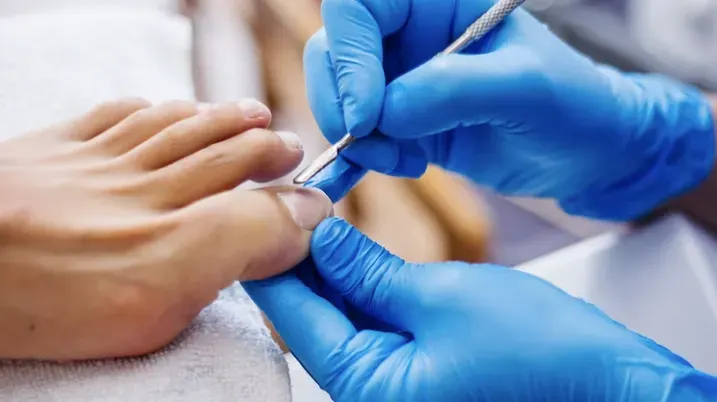 ingrown toenail removal in willetton