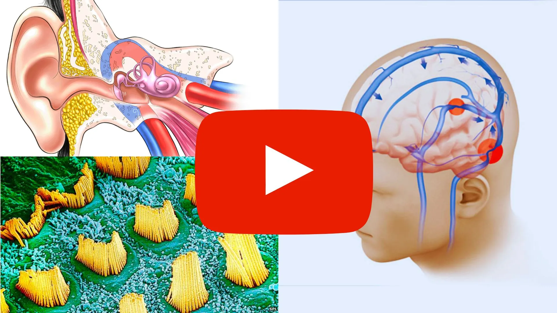 Did you know that memory loss has 4 Stages Tinnitus is one!