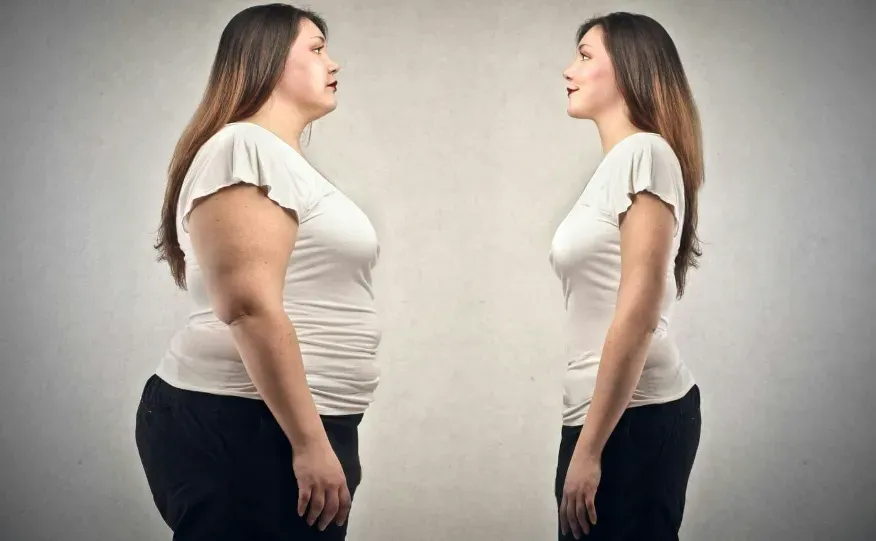 two side-by-side profiles of the same woman, one depicting her as obese and the other as normal-sized.