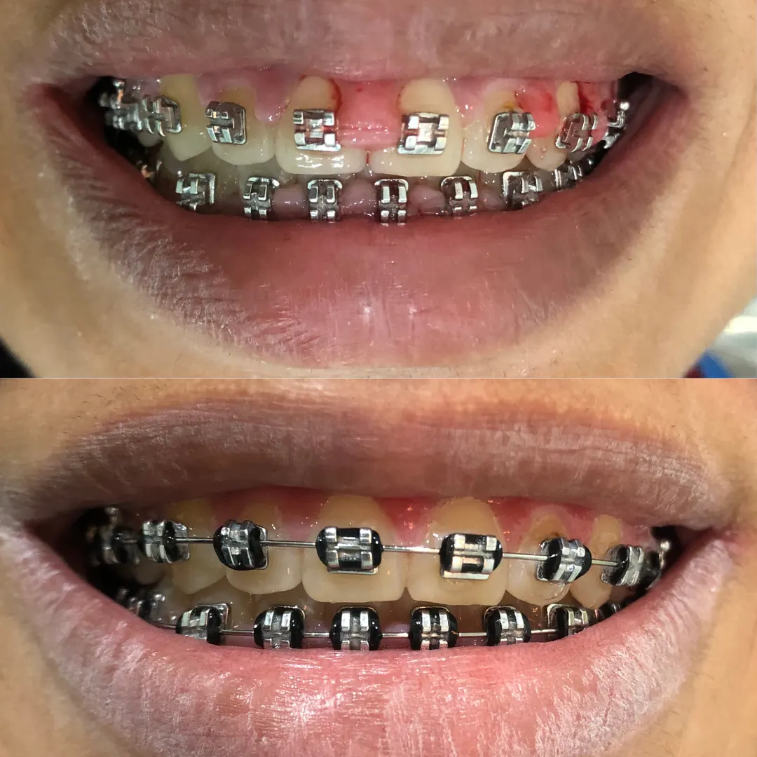 dentista aparelho centro niteroi rj