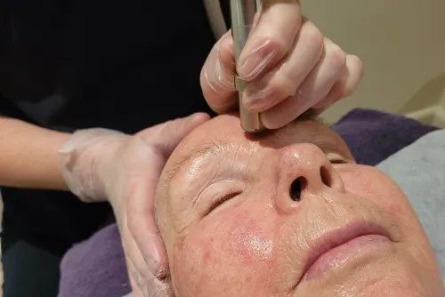 Ella Bache Microdermabrasion for facial skin care