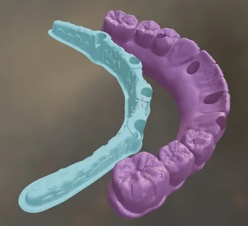 barra para implante cad cam