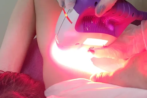 Female hair removal waxing in hobart