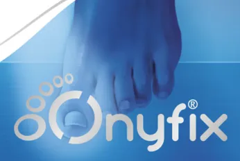 Onyfix Nail Correction SYstem
