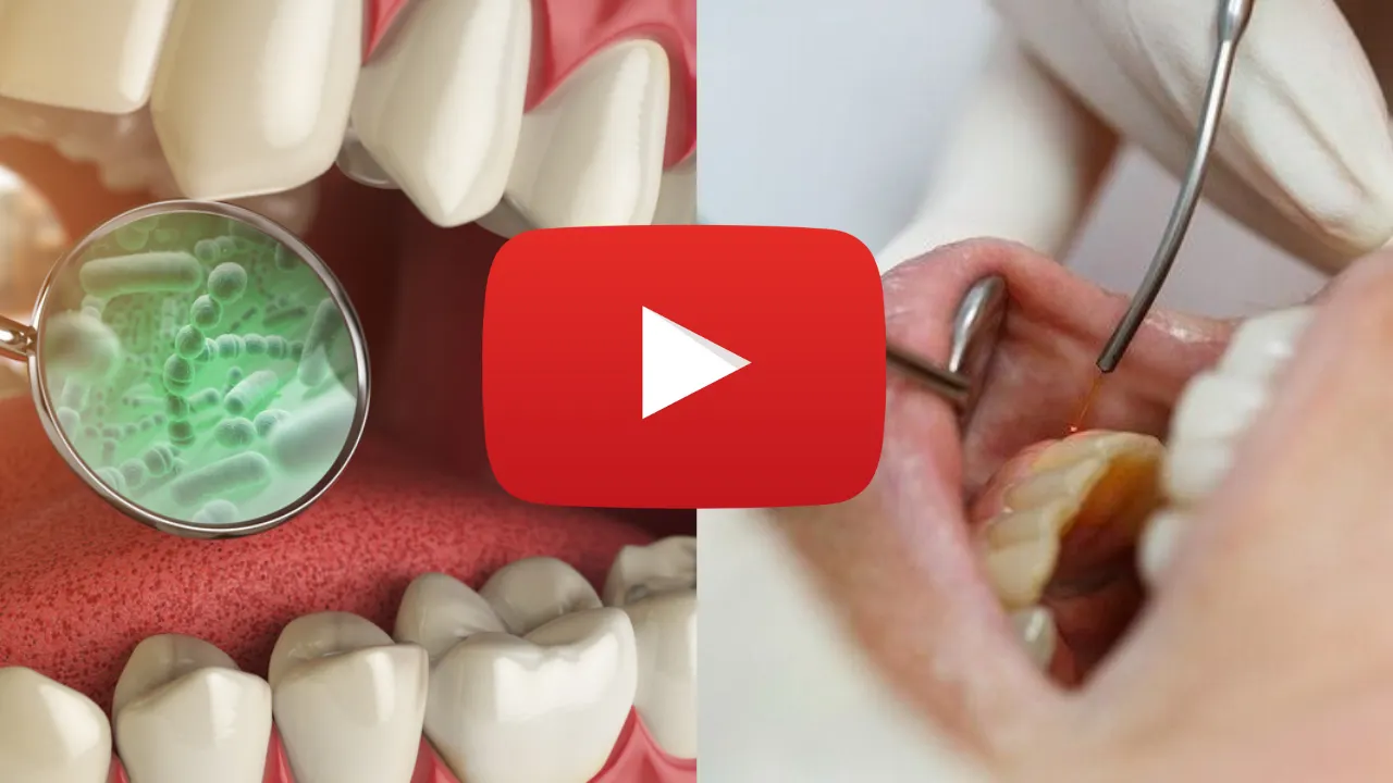 Amazing Dental Breakthrough