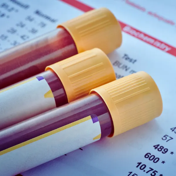 Evidence Based Testing