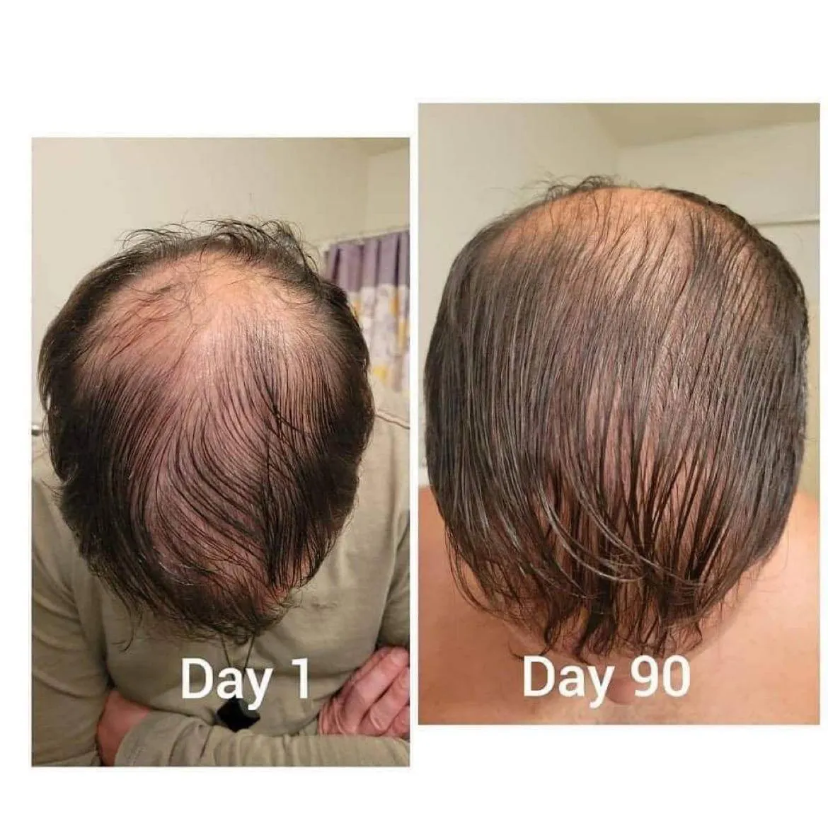 Liquid Collagen Results Hair Growth
