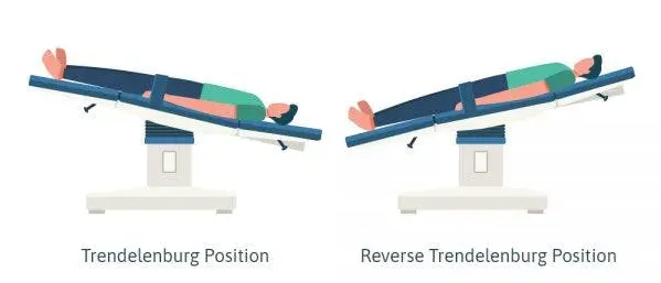 the Mild Trendelenburg Position