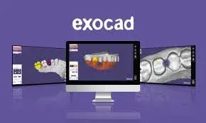 projeto digiral exocad protese odontologica