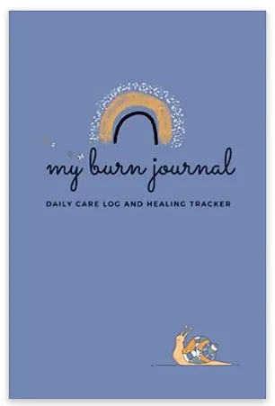 My Burn Journal