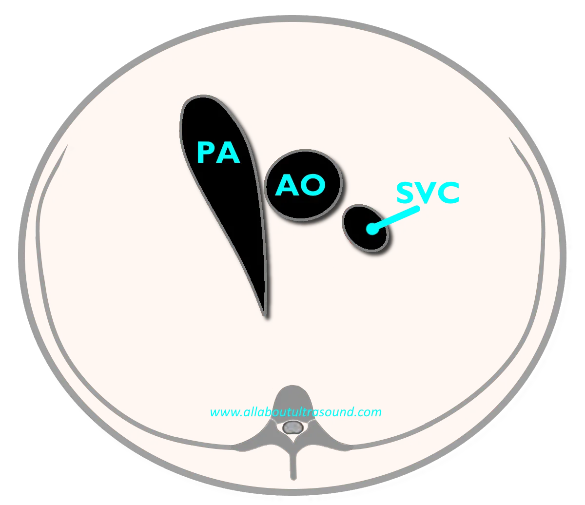 3 vessel view