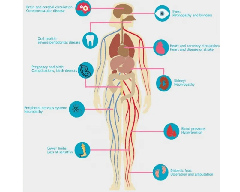 Diabetes effects on the body