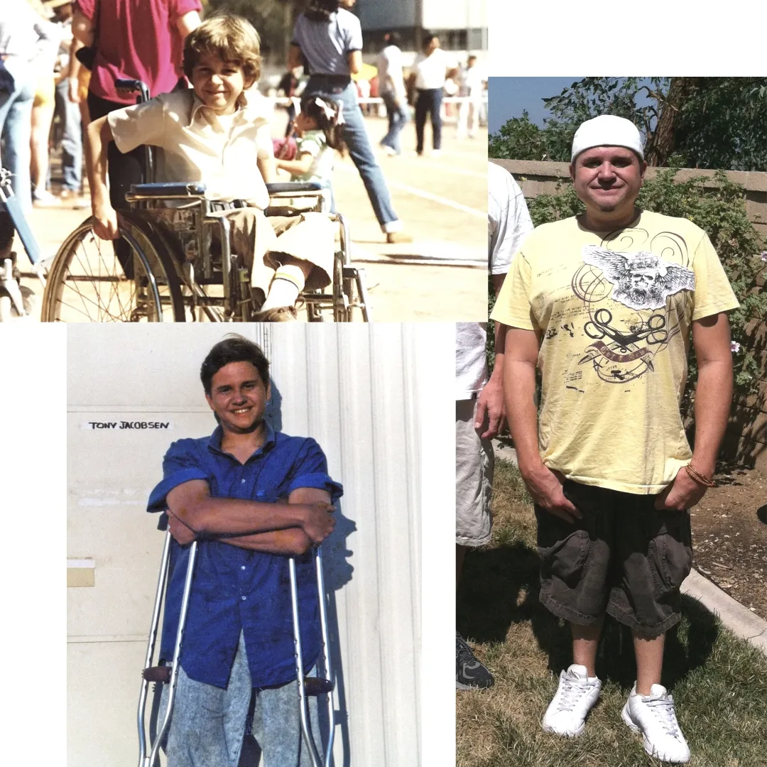 Tony Jacobsen collage; sitting in a wheelchair, using crutches and overweight