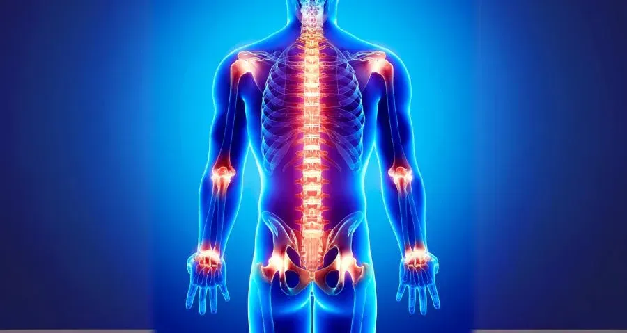 A translucent body with a radiant glow around the joints to represent inflammation.