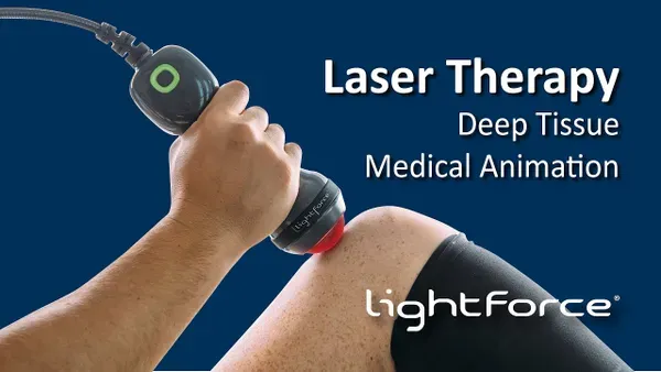 light force laser therapy podiatry 