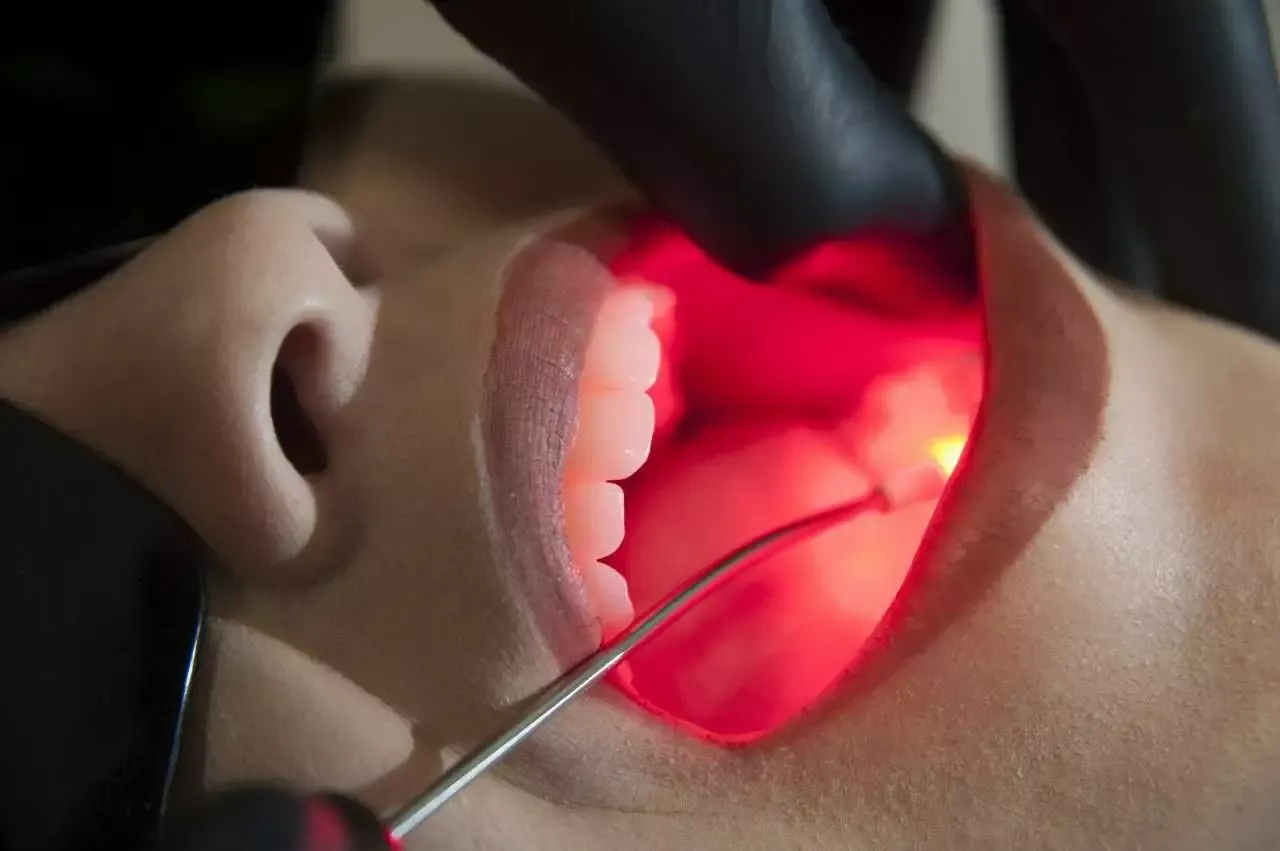tratamento mucosite