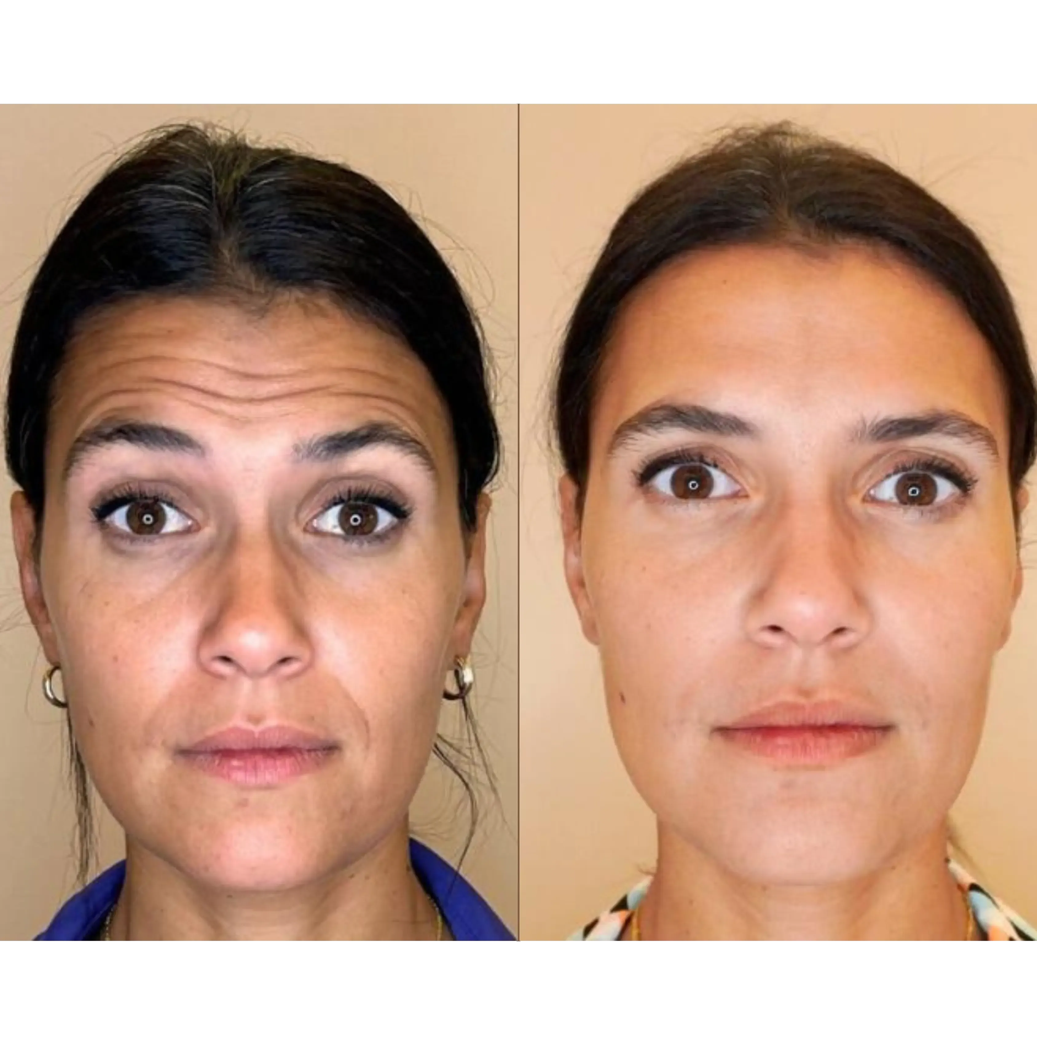 clinica odontologica harmonizacao facial odontocompany balsas ma