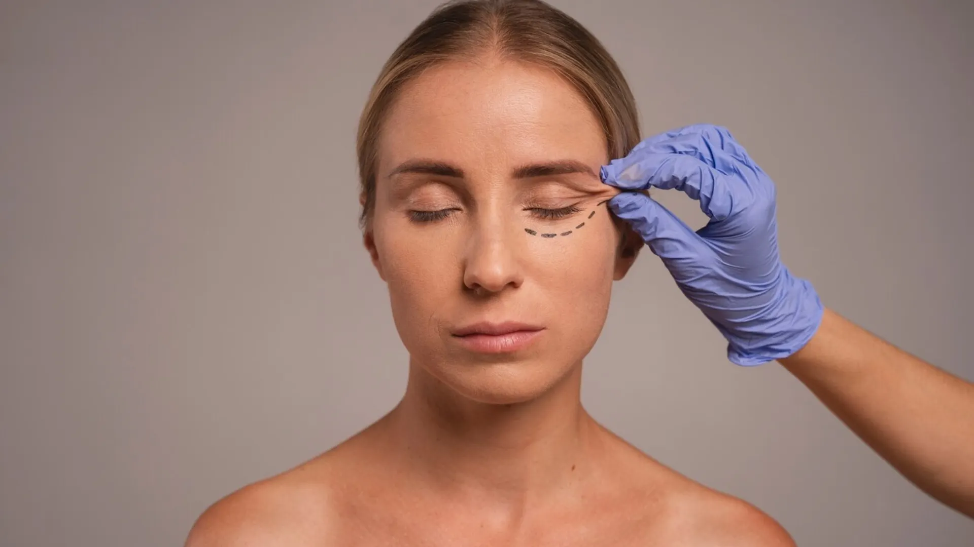 Blepharoplasty