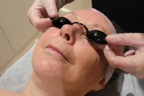 Ella Bache IPL Intense Pulse Light Therapy