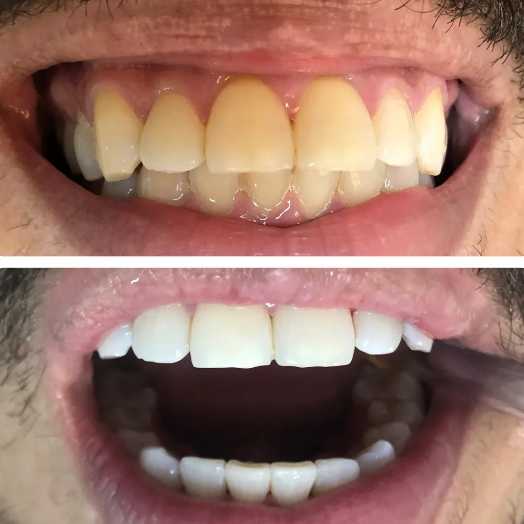 dentista clareamento dental centro niteroi rj