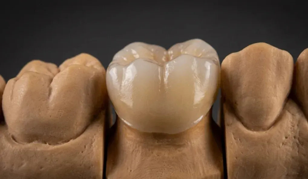 fresagem de dissilicato de litio emax cad cam