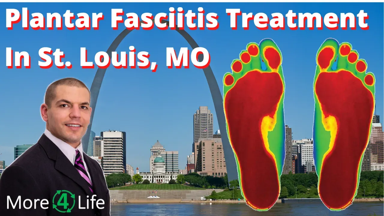 Hey its Dr. Dave Candy owner of More 4 Life in St. Louis MO! Do you suffer from plantar fasciitis? Plantar fasciitis refers to pain on the bottom of your foot or in your heel.  Plantar fasciitis often hurts first thing in the morning when first stepping down on your foot.  Plantar fasciitis tecnically means 'inflammation in the plantar fascia', or the tendon in the bottom of your foot. But lots of other things besides plantar fasciitis can cause heel pain or pain in the bottom of your foot. Muscle problems, nerve problems, and even disc problems can mimick the syptoms of plantar fasciitis.  If plantar fasciitis keeps you from being on your feet for a long time, being as active as you'd like during the day, or from sleeping at night, then we'd love to help!  Our treatment for plantar fasciitis near St. Louis, MO gives you the best chance to relieve plantar fasciitis, not just temporarily, but over the long term. If you'd like to learn more about our treatment for plantar fasciitis near St. Louis, MO, then there are multiple wasy sthat we can do that! You can download a download a copy of my FREE Plantar Fasciitis E-book by clicking on the button below.  It's full of self-treatments for plantar fasciitis that you can start to use to get plantar fasciitis relief today!  There's even information in there for you as to how our plantar fasciitis specialist in St Louis MO can help! After reading if you have any questions for our plantar fasciitis specialist, feel free to reach out and I’m happy to help…and if not, that’s fine too.  But don’t go on living unnecessarily with plantar fasciitis pain even one more day when our plantar fasciitis specialist can probably help you!    Just click on the link below to download your copy of the plantar fasciitis e-book today and get started on the road to a happier, healthier, less painful life!