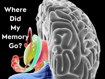 Where Did My Memory Go?