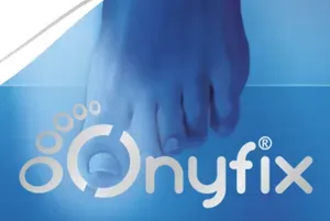 Onyfix Nail Correction SYstem