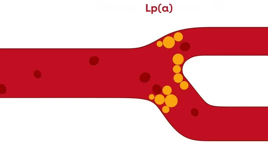 Understanding Lipoprotein(a) and Its Impact on Cardiovascular Health