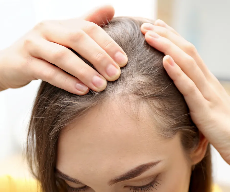 Hair Thinning And Changes