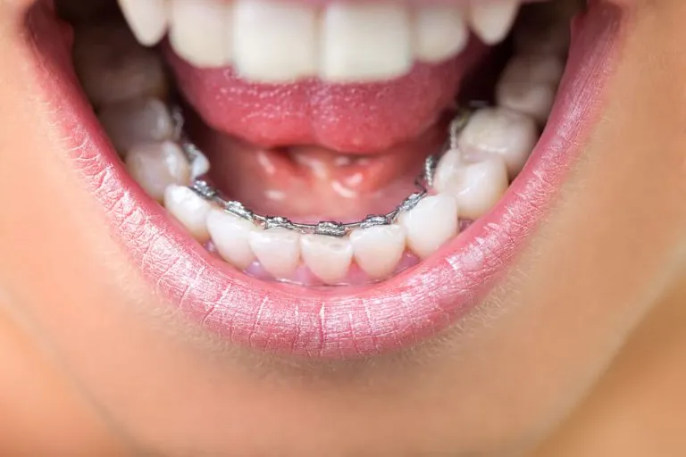 dentista canal