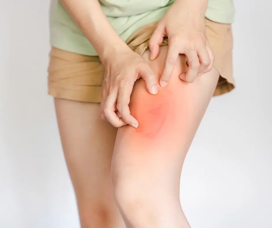 rashes unexplained symptoms