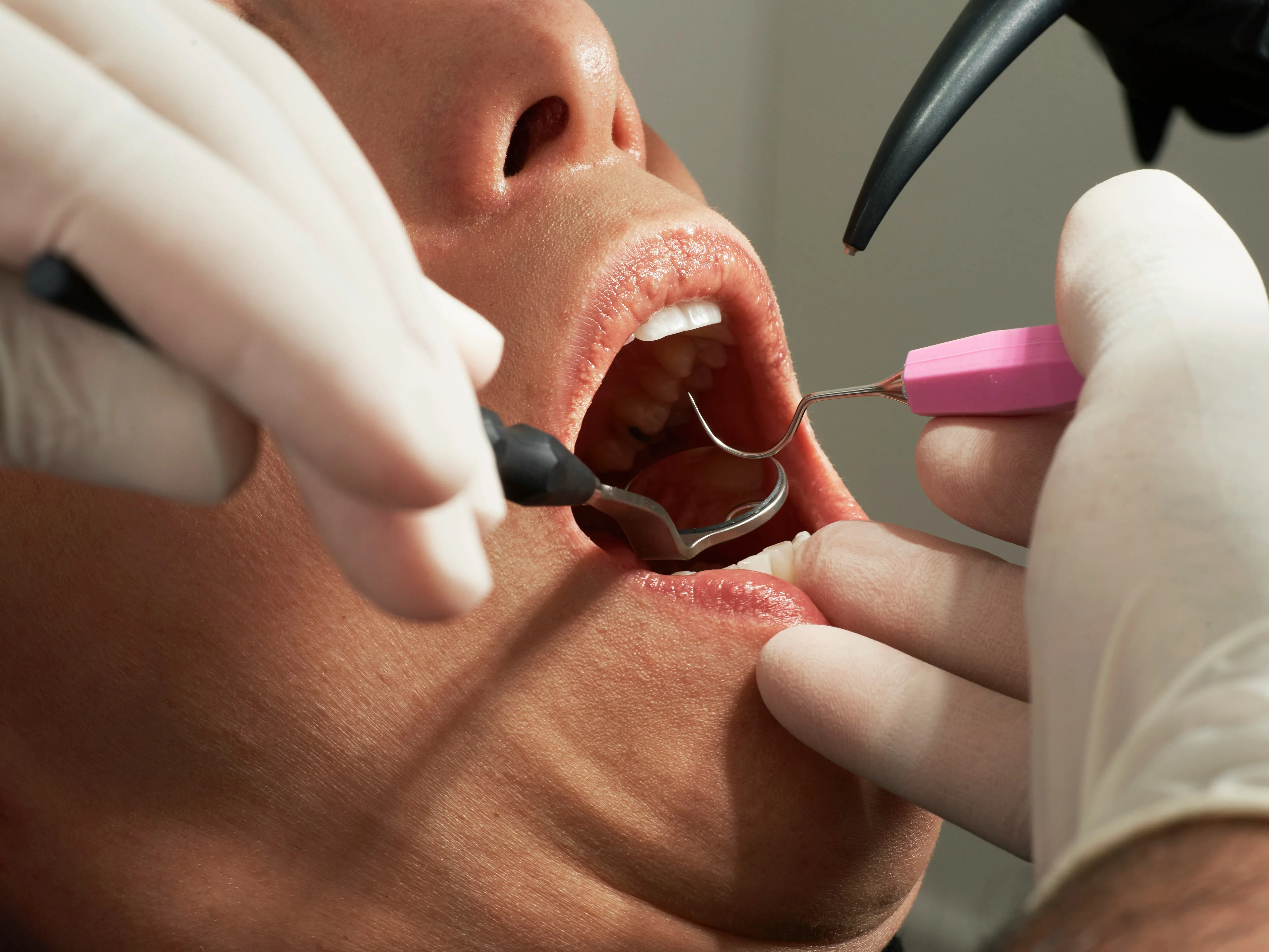Dental