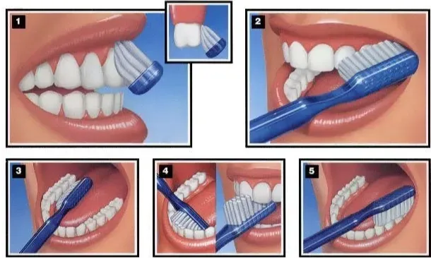 a step-by-step visual guide illustrating the correct brushing technique, including brush angles and strokes.